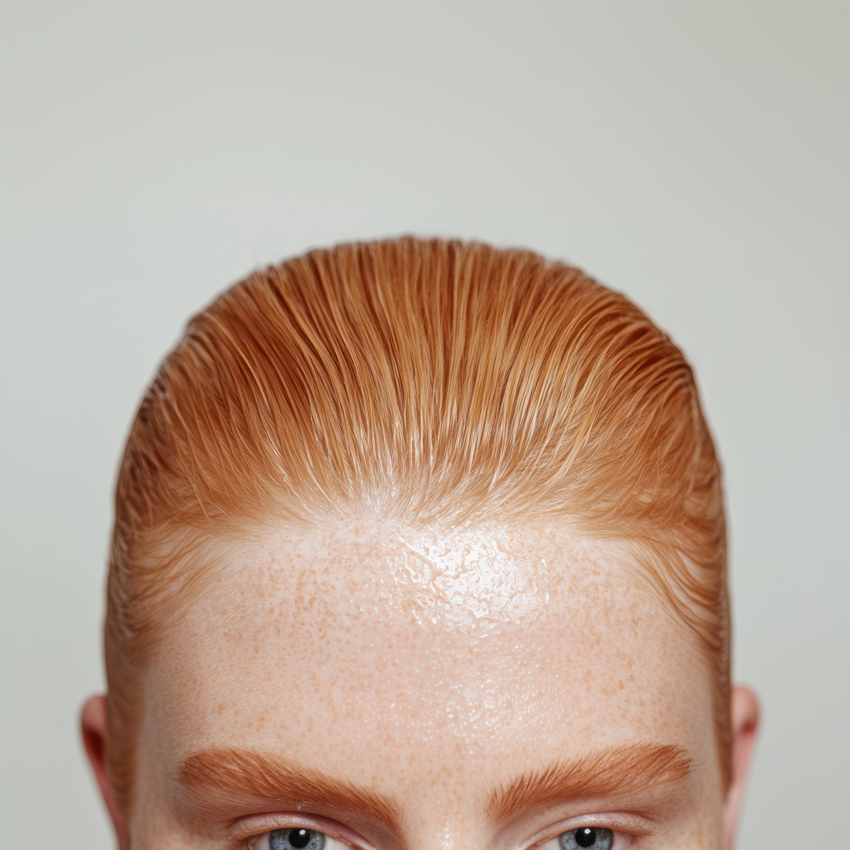 Scalp Buildup: Causes, Signs, and How to Restore Balance Naturally - L'Ouest